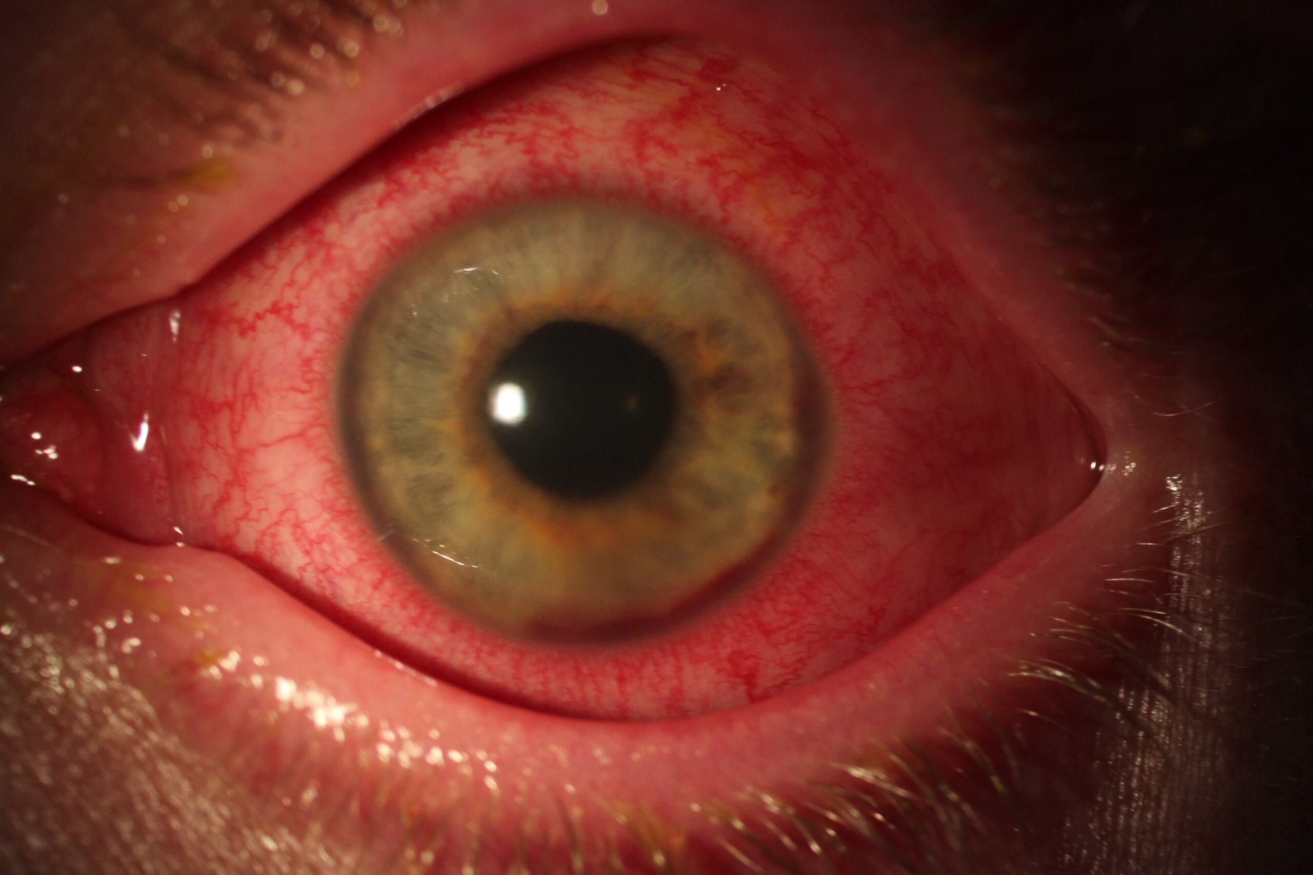 Retina Specialists of Mississippi - Board Certified Eye Doctors